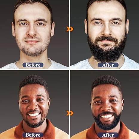 Beard Growth Kit for Men – Oil, Balm, Comb, & Patchy Beard Solution – Perfect Gift for Him